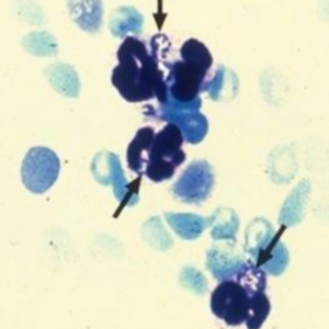 Blood smear showing Anaplasma phagocytophilum bacteria.