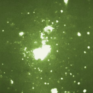Fluorescent microscope image showing Rickettsia rickettsii bacteria.