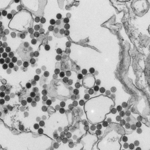 Electron microscopic image of Heartland virus.